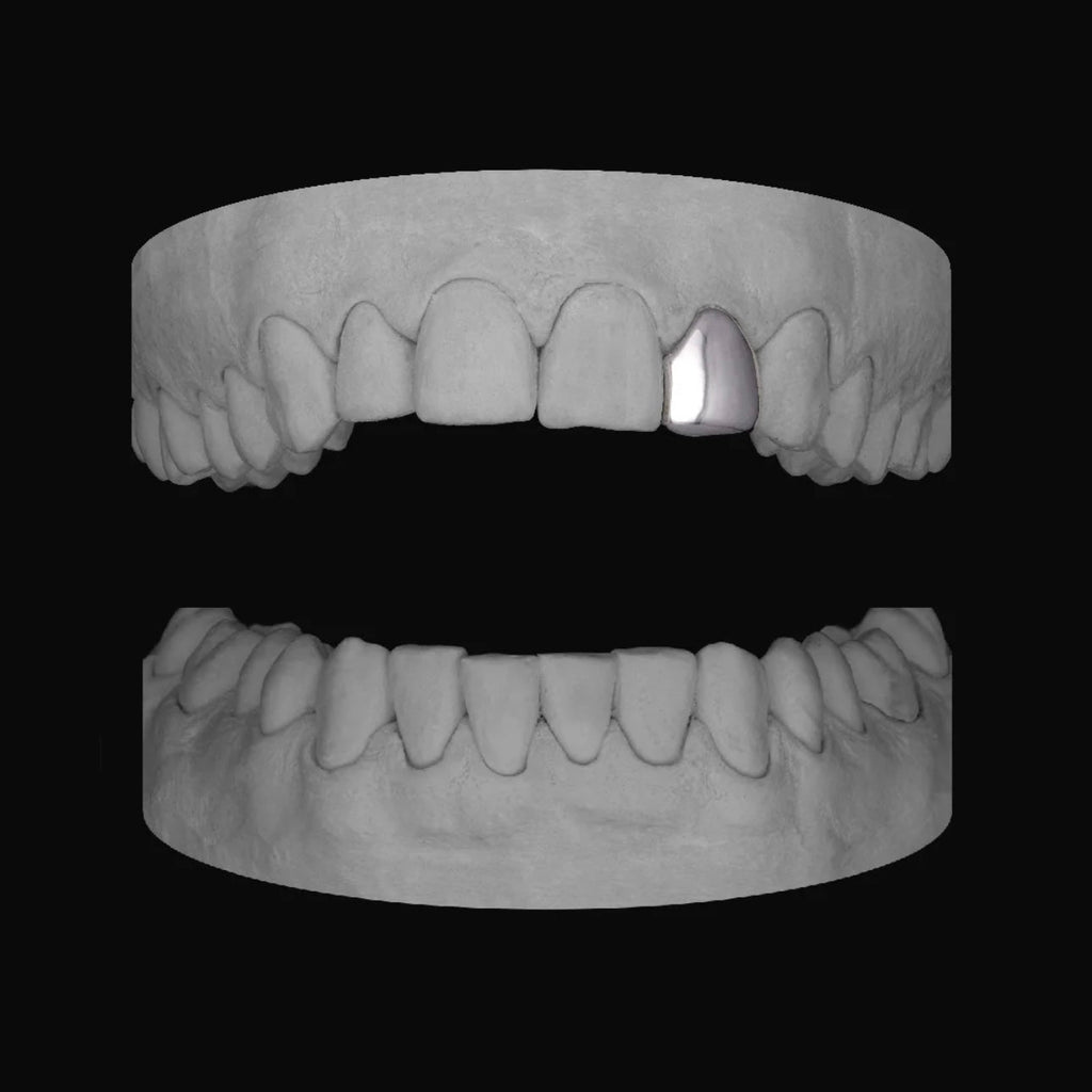 Lateral - Bitez Grillz