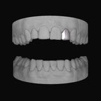 Lateral - Bitez Grillz