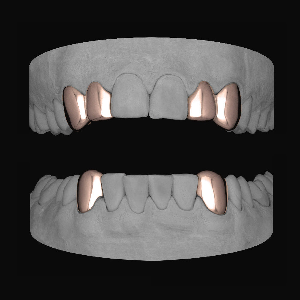 2 x Canine and Lateral & Bottom Canines - Bitez Grillz