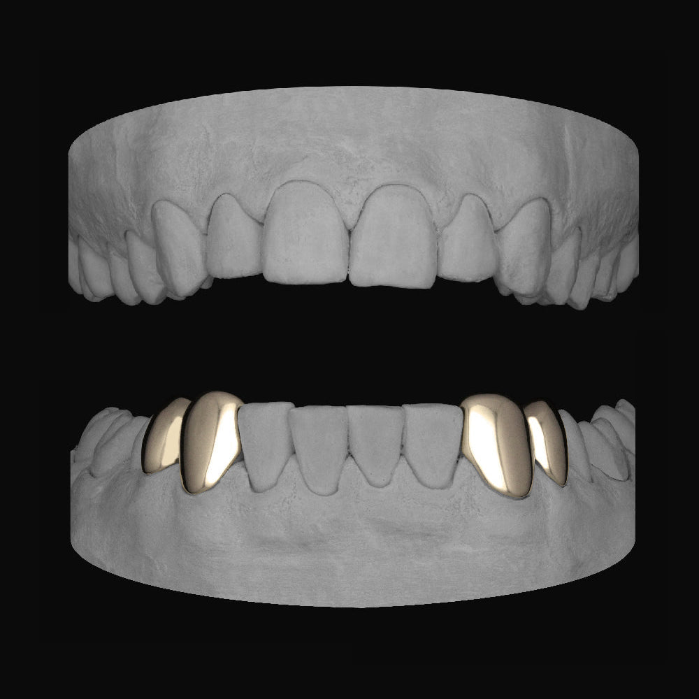 2 x Canine & premolar (Lower) - Bitez Grillz