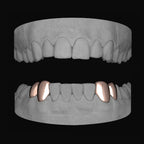 2 x Canine & premolar (Lower) - Bitez Grillz