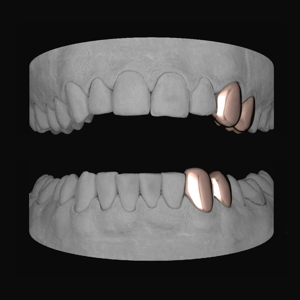 2 x Canine & Premolar (Upper & Lower) - Bitez Grillz