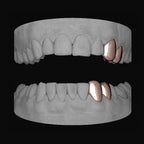2 x Canine & Premolar (Upper & Lower) - Bitez Grillz