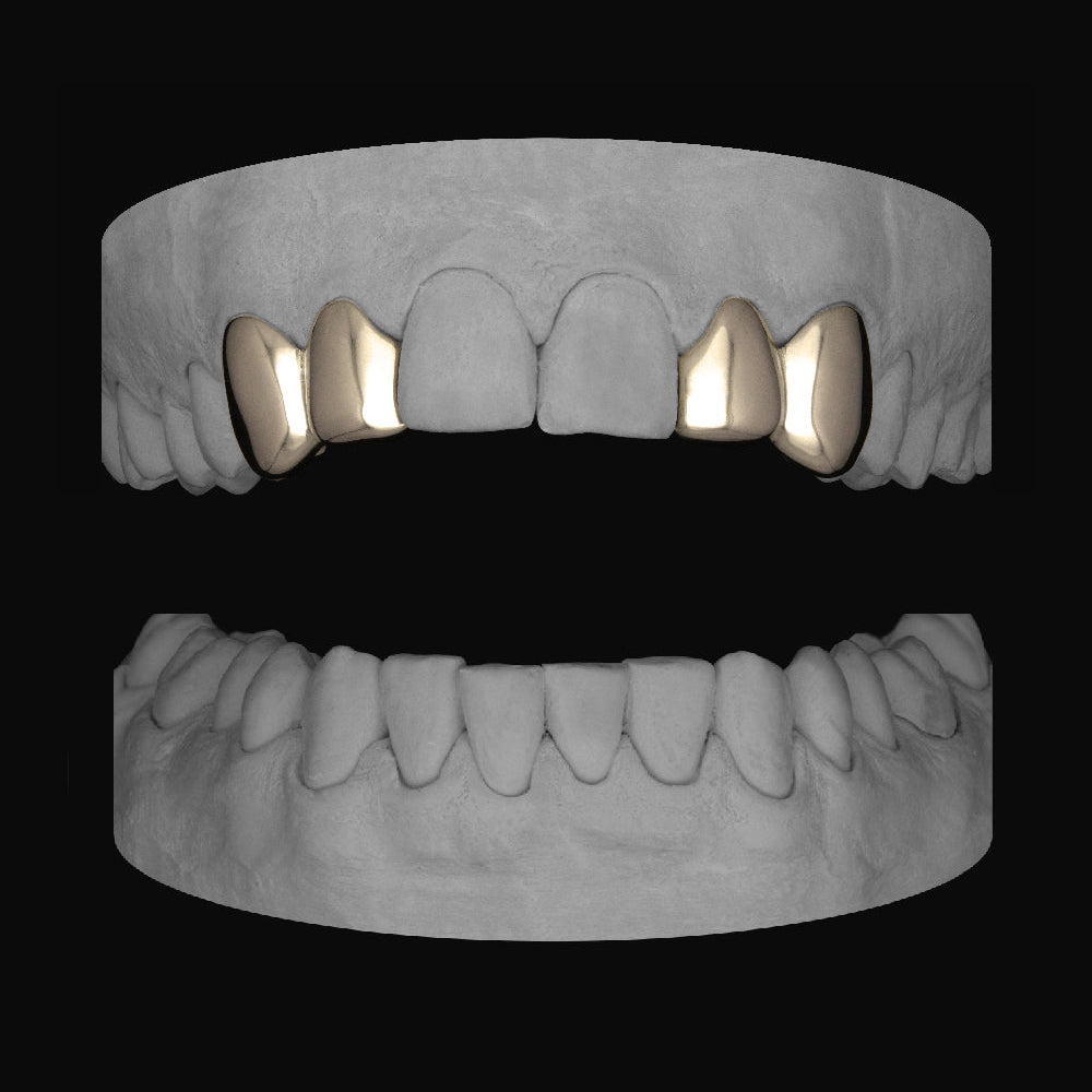 2 x Canine & Lateral - Bitez Grillz