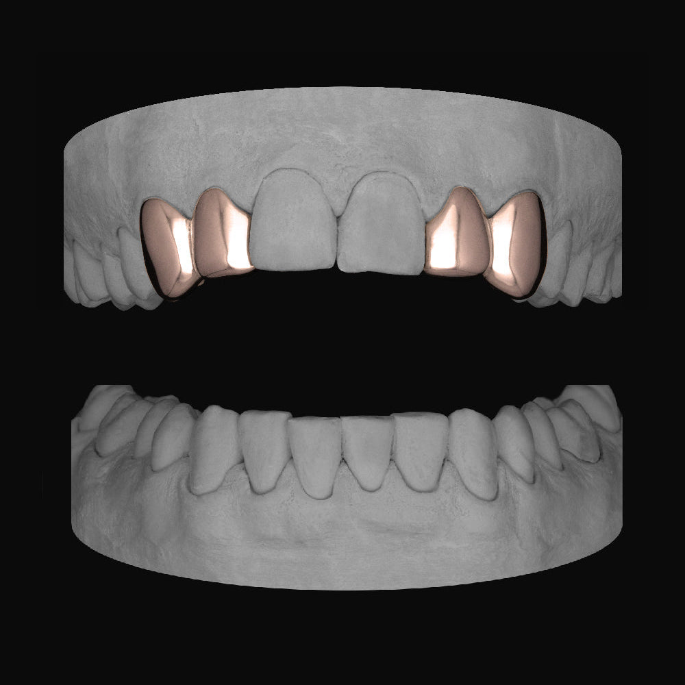 2 x Canine & Lateral - Bitez Grillz