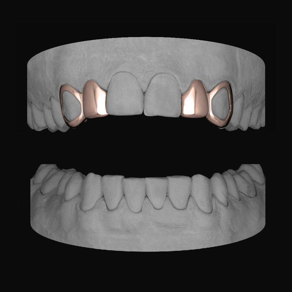 2 x Window Canine & Lateral - Bitez Grillz