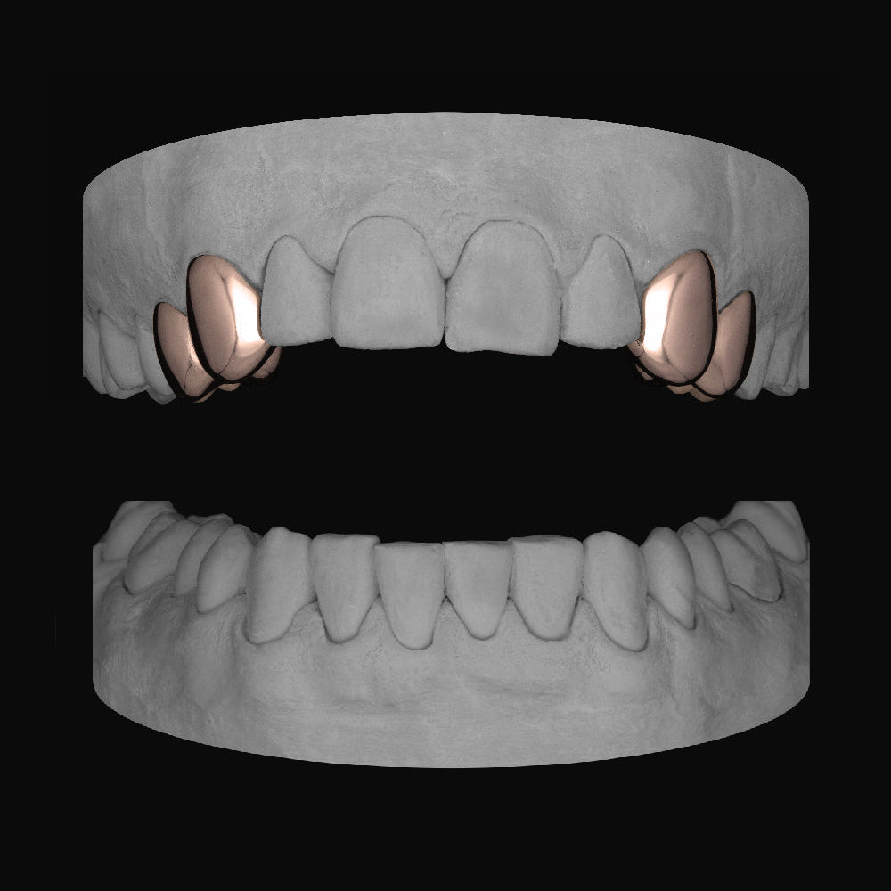 2 x Canine & Premolar (upper) - Bitez Grillz