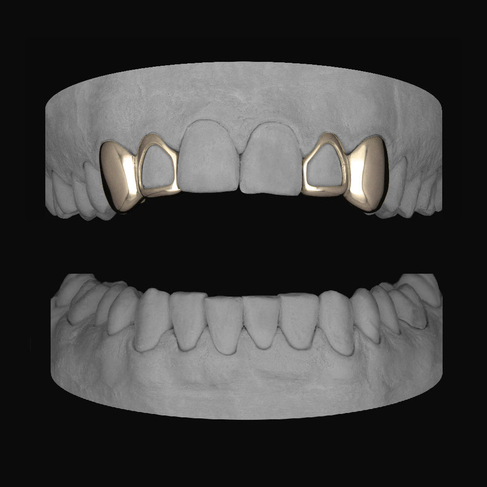 2 x Canine & Window Lateral - Bitez Grillz