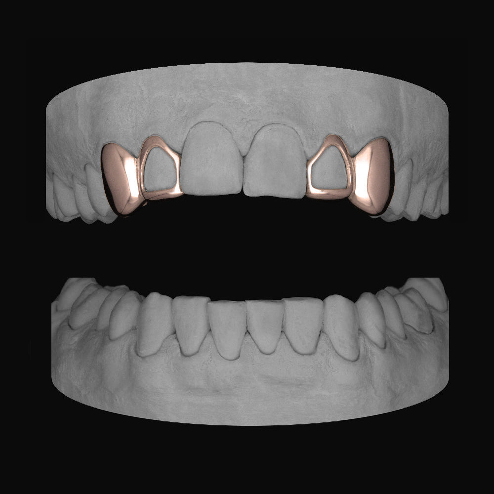 2 x Canine & Window Lateral - Bitez Grillz