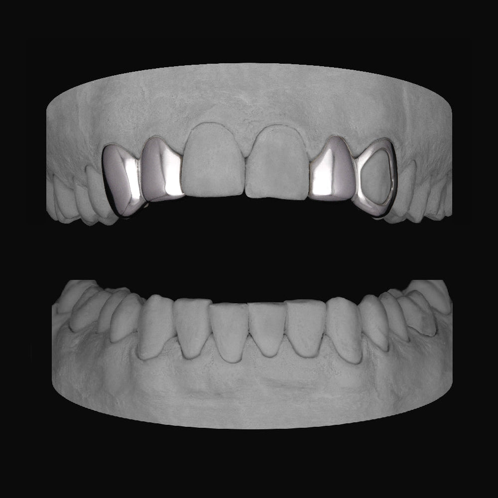 Canine & Lateral - Lateral & Window Canine - Bitez Grillz