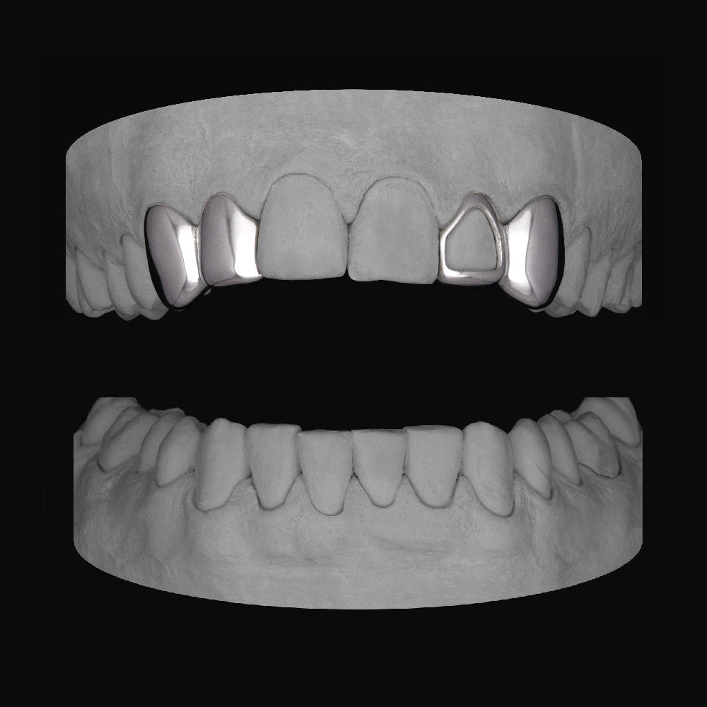 Canine & Lateral - Window Lateral & Canine - Bitez Grillz