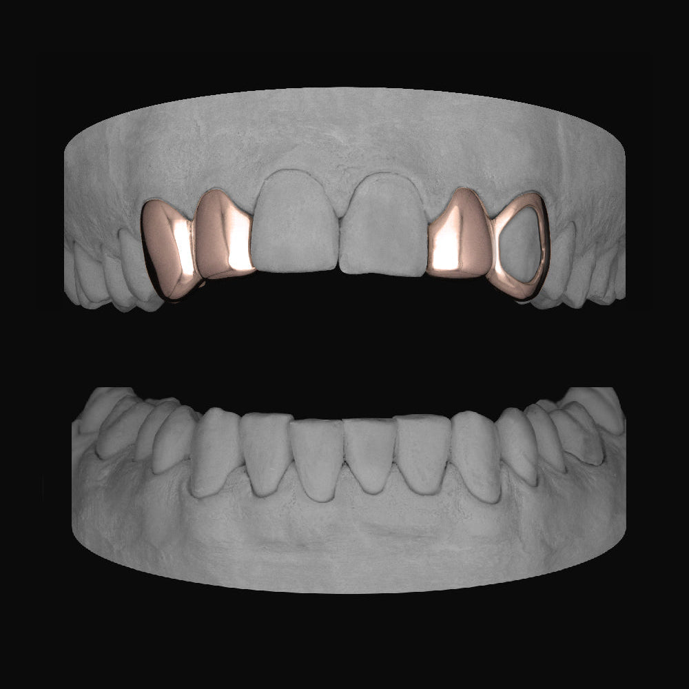 Canine & Lateral - Lateral & Window Canine - Bitez Grillz