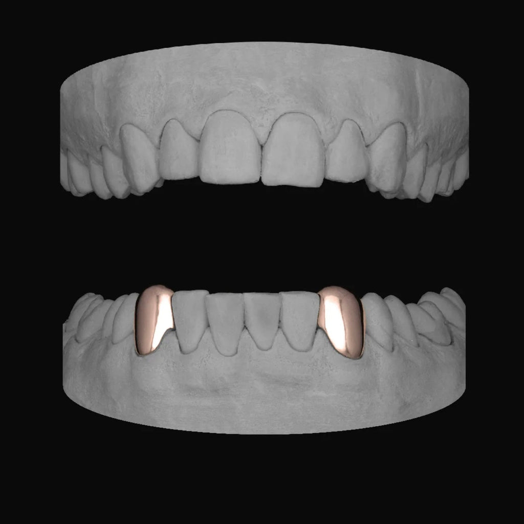 Canine - Canine (Lower) - Bitez Grillz