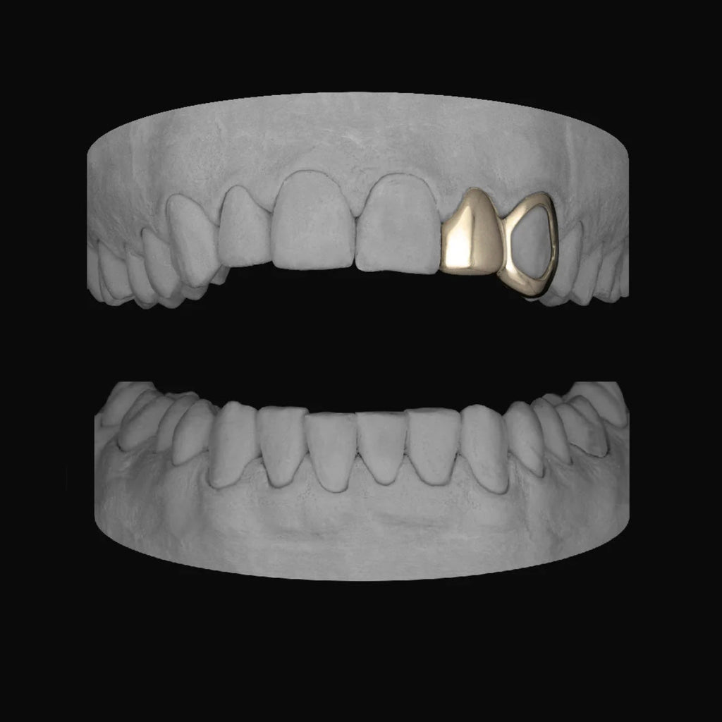 Lateral & Window Canine - Bitez Grillz