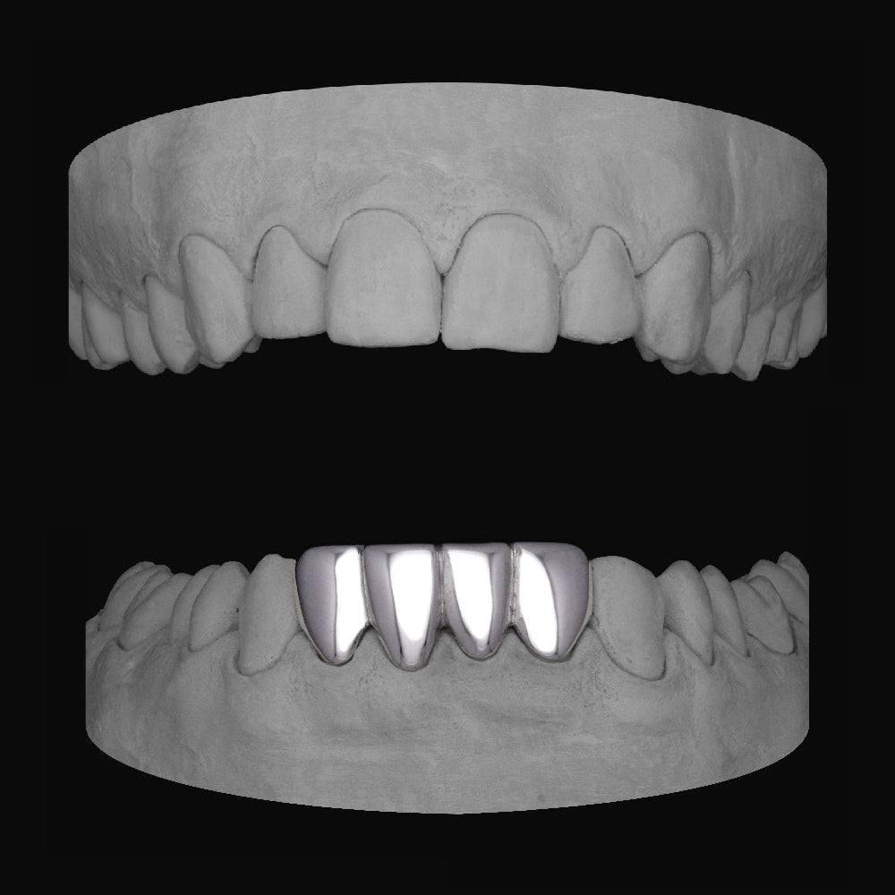 Lower 4 Set - Bitez Grillz