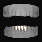 Lower 4 Set - Bitez Grillz