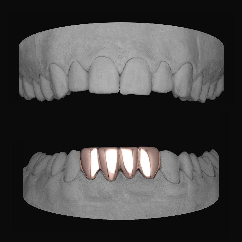 Lower 4 Set - Bitez Grillz