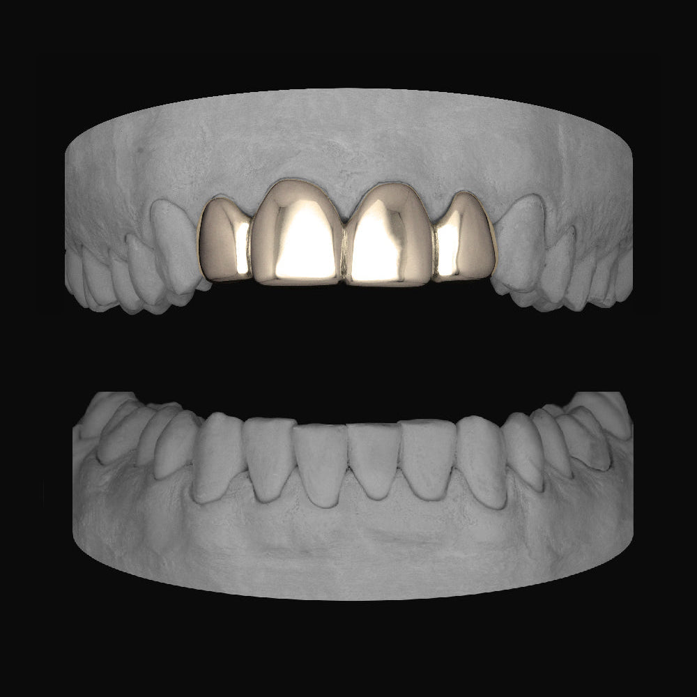 Top 4 Set - Bitez Grillz