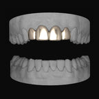 Top 4 Set - Bitez Grillz