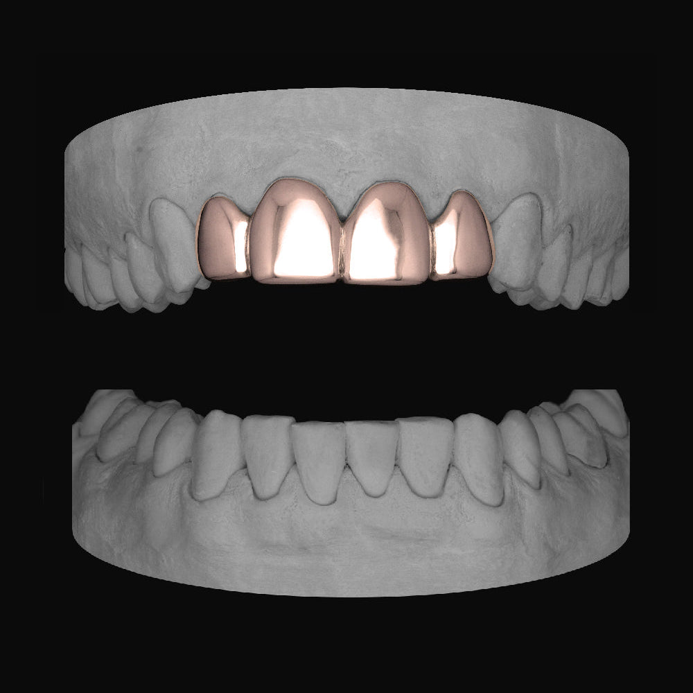 Top 4 Set - Bitez Grillz