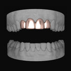 Top 4 Set - Bitez Grillz