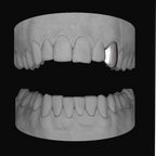 Canine - Bitez Grillz