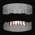Bottom 6 - Bitez Grillz