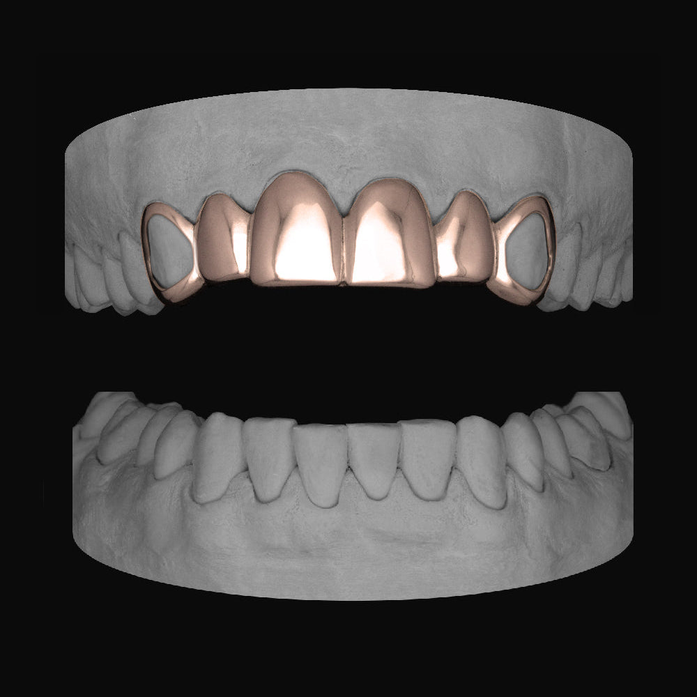 6 Set Window Canines - Bitez Grillz