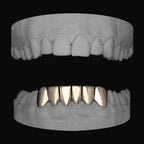 Bottom 6 - Bitez Grillz