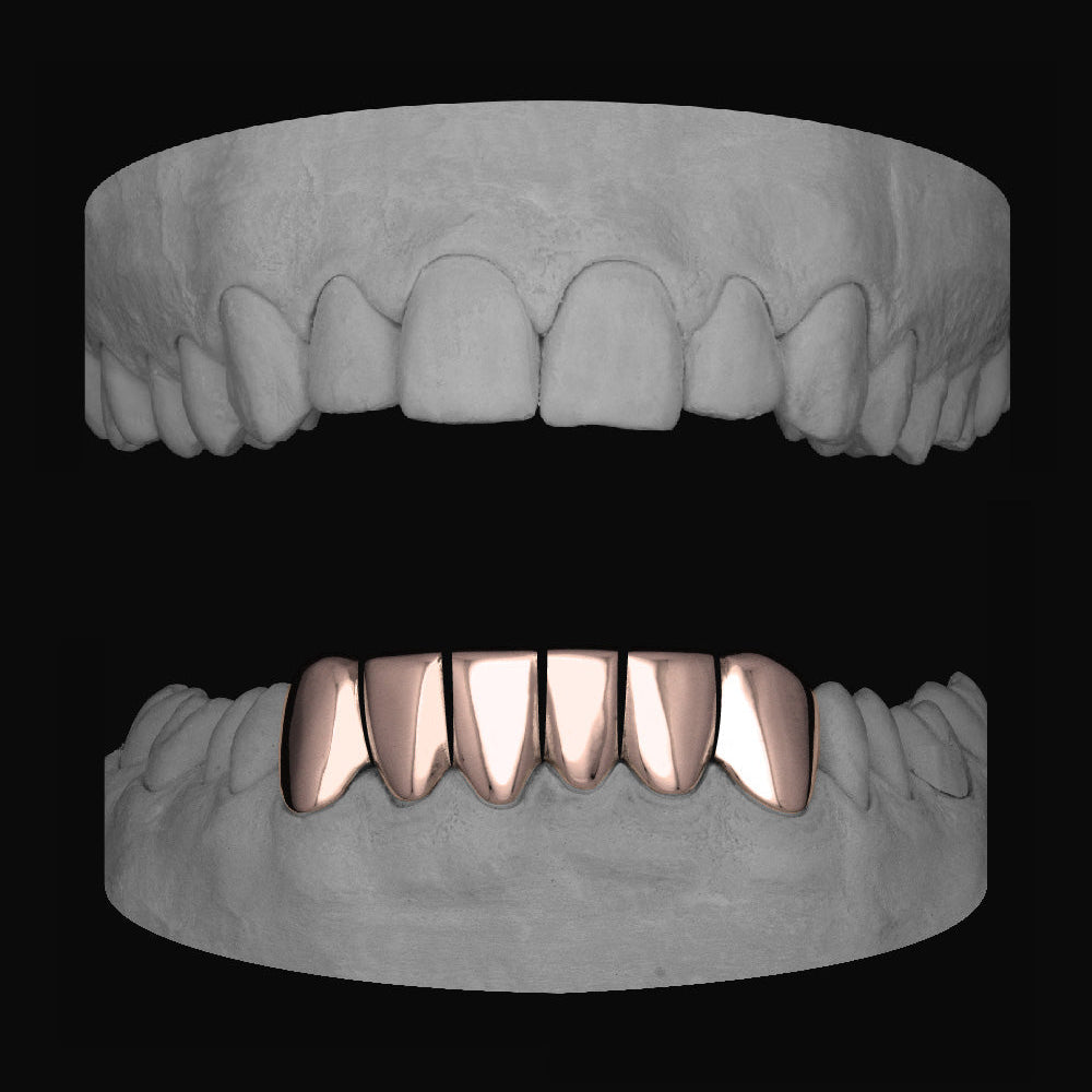 Bottom 6 - Bitez Grillz