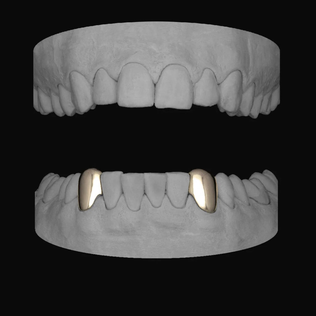 Canine - Canine (Lower) - Bitez Grillz