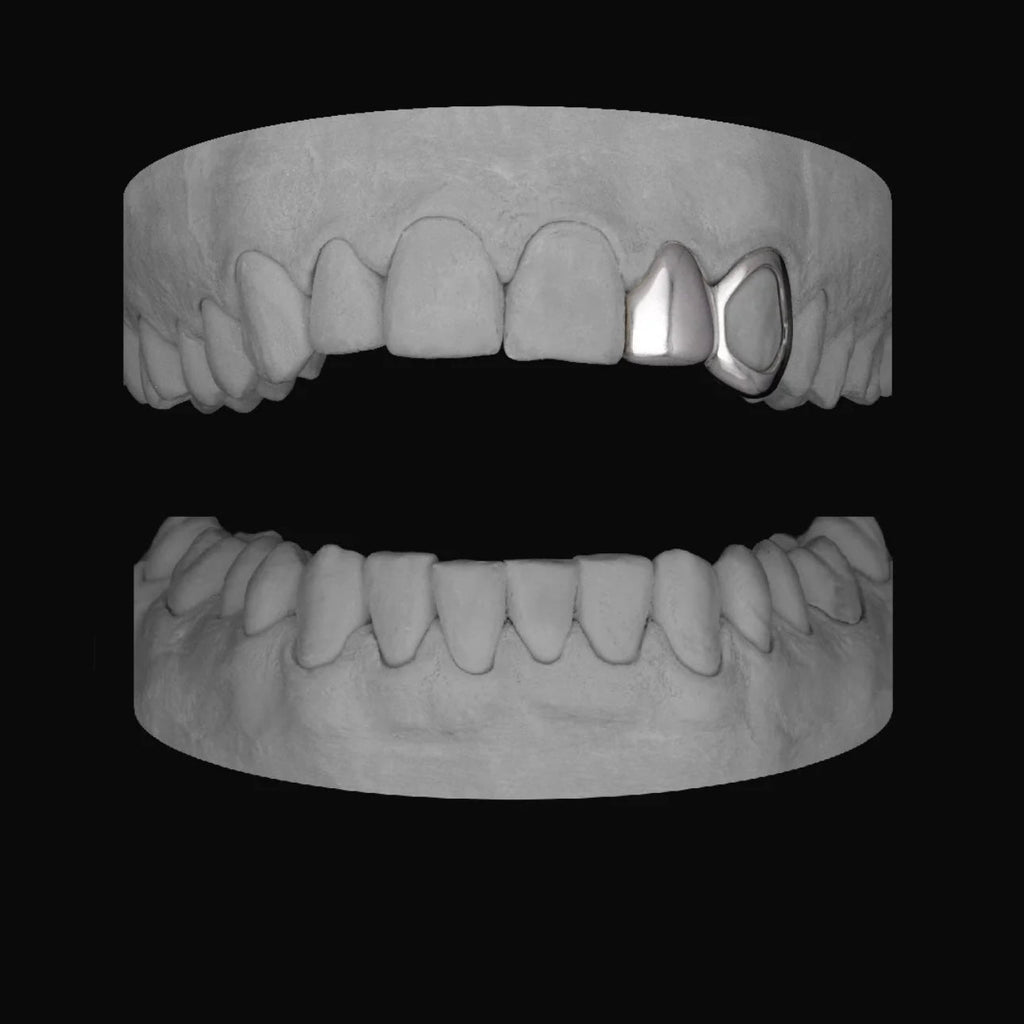 Lateral & Window Canine - Bitez Grillz