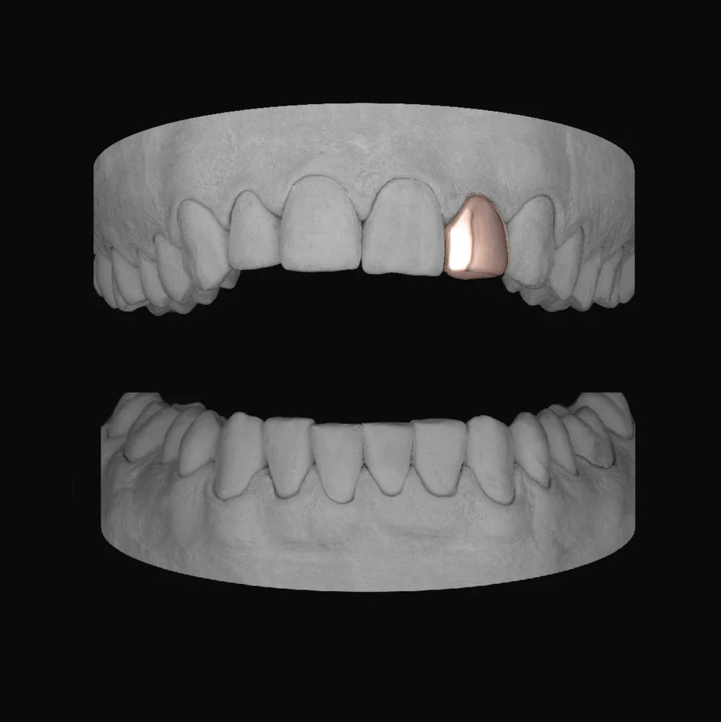 Lateral - Bitez Grillz