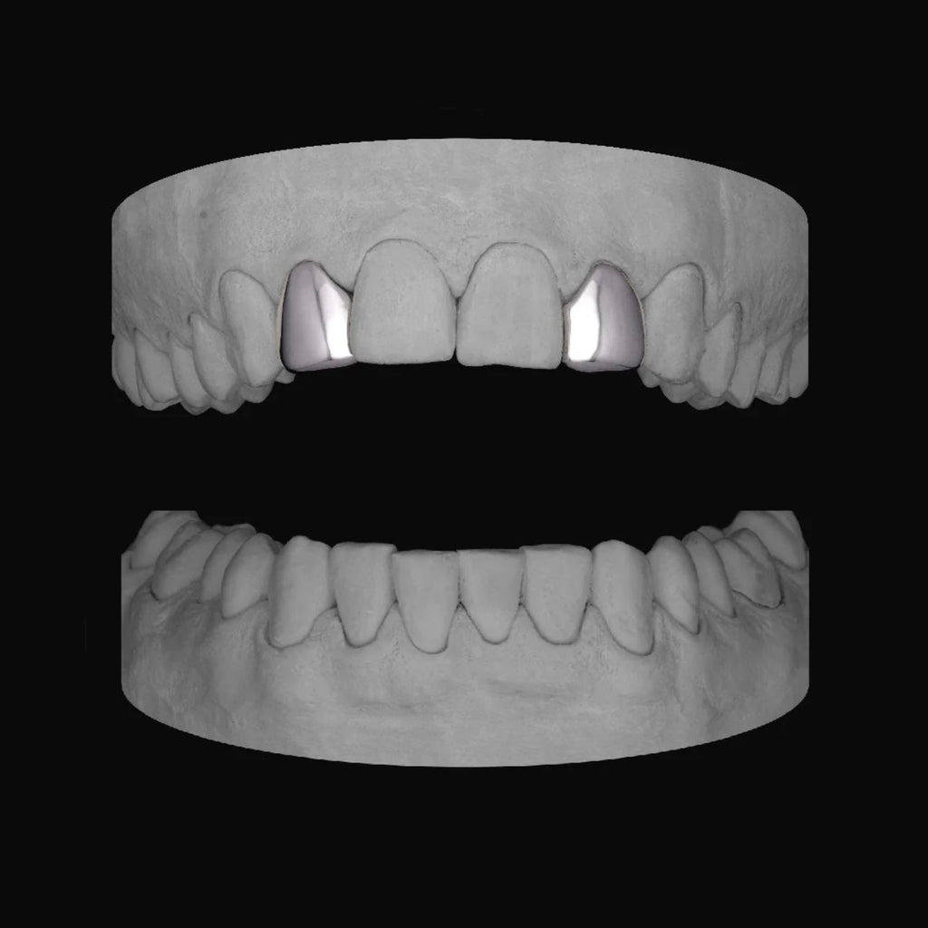 Lateral - Lateral - Bitez Grillz