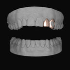 Lateral & Heart Canine - Bitez Grillz