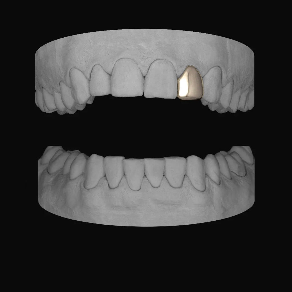 Lateral - Bitez Grillz