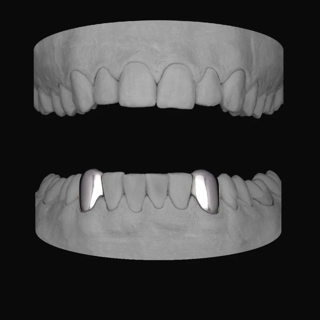 Canine - Canine (Lower) - Bitez Grillz