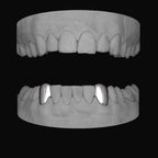 Canine - Canine (Lower) - Bitez Grillz
