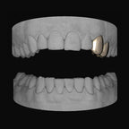 Canine & Premolar (Upper) - Bitez Grillz