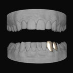 Canine & Premolar Lower - Bitez Grillz