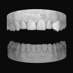 Diamond Canine - Bitez Grillz