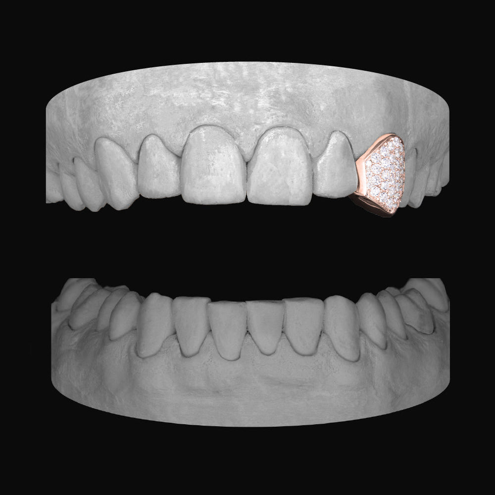 Diamond Canine - Bitez Grillz