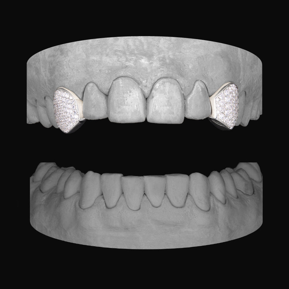 Diamond Canine - Canine - Bitez Grillz