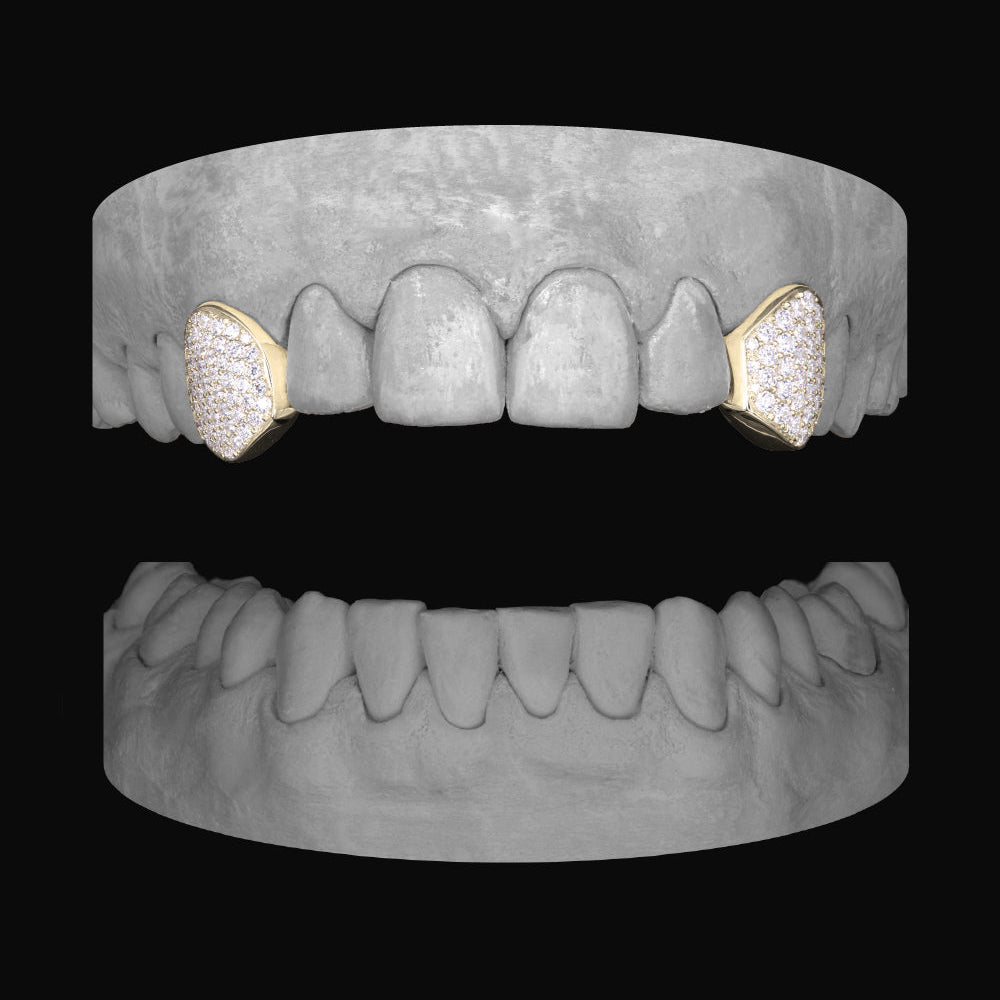 Diamond Canine - Canine - Bitez Grillz