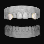 Diamond Canine - Canine - Bitez Grillz
