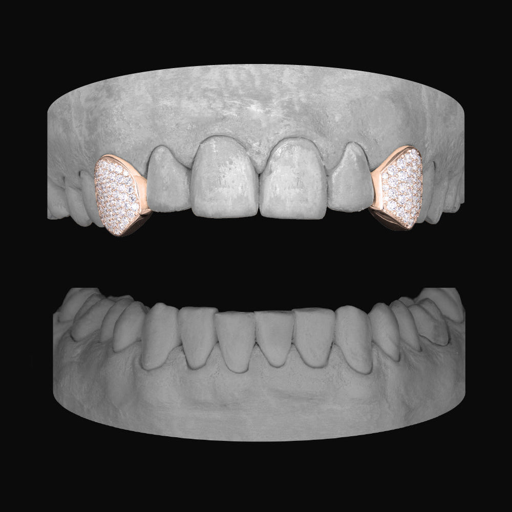 Diamond Canine - Canine - Bitez Grillz