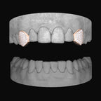 Diamond Canine - Canine - Bitez Grillz