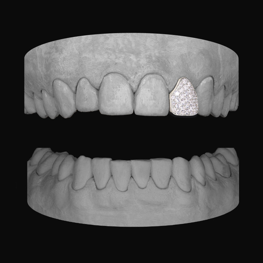 Diamond Lateral - Bitez Grillz