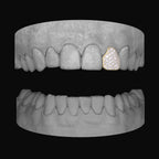 Diamond Lateral - Bitez Grillz