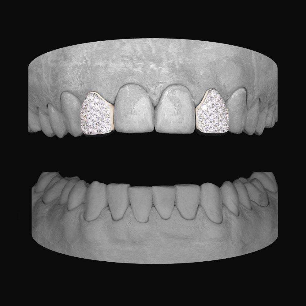 Diamond Lateral - Lateral - Bitez Grillz